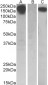 CSF1R (aa 700-710) Antibody (internal region)