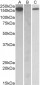 CSF1R (aa734-744) Antibody (internal region)