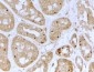 NOLC1 Antibody (internal region)