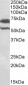 BIRC3 Antibody (internal region)