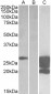 GM2A (aa 164-175) Antibody (internal region)