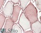 TRIM72 Antibody (internal region)