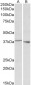 PCBP1 (aa223-234) Antibody (internal region)