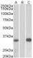 KCNIP3 Antibody (internal region)