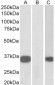 KCNIP3 Antibody (N-Term)