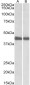 IDH1 (aa65-77) Antibody (internal region)