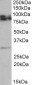 GPM6A Antibody (internal region)