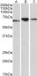 POLDIP2 Antibody (internal region)