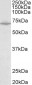 Creatine transporter 1 / SLC6A8 Antibody (internal region)