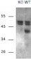 Calcipressin-1 Antibody (internal region)