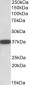 CYB5R3 / Dia 1  Antibody (C-Term)