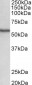 NDR1 / STK38 Antibody (C-Term, near)