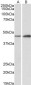 NDRG2 Antibody (N-Term, near)