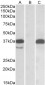 PIM2 Antibody (C-Term)