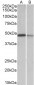 TXNDC5 (aa281-295) Antibody (internal region)