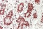 STS2 / TULA (aa470-482) Antibody (internal region)