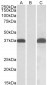 PIM2 (aa23-36) Antibody (internal region, near N-Term)