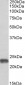 MNSOD (isoform A) Antibody (internal region)