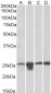 MNSOD (aa119-130) Antibody (internal region)