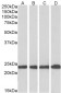 MNSOD (aa119-130) Antibody (internal region)