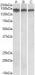 IDH3A Antibody (C-Term)