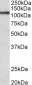 thyroid peroxidase Antibody (internal region)