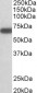 GAD25 / GAD67 Antibody (internal region)