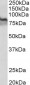 Transglutaminase 2 (aa578-591) Antibody (internal region)