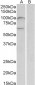 UNC5B (aa629-643) Antibody (internal region)