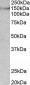 SYNGAP1 (aa1169-1183) Antibody (internal region, near C-Term)