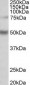 ULK3 (aa445-458) Antibody (C-Term)