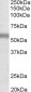 NPR3 (aa520-533) Antibody (C-Term)