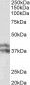 HP beta chain Antibody (internal region)