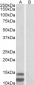 p15INK4b (isoform 2) Antibody (C-Term)