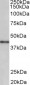 Cyclin D-type binding-protein 1 (aa322-333) Antibody (internal region, near C-Term)
