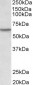 LCK (aa39-52) Antibody (internal region, near N-Term)