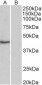TBP /Transcription factor IID (isoform1) Antibody (N-Term)
