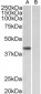TBP /Transcription factor IID (aa39-50) Antibody (internal region)