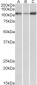 SERCA2 / ATP2A2 Antibody (internal region)