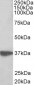 AIMP1 /  SCYE1 Antibody (N-Term)