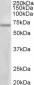 PRMT3 (aa468-421) Antibody (internal region)