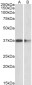 PRMT2 Antibody (internal region)