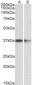 PRMT2 Antibody (internal region)