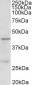 PRMT6 Antibody (internal region)