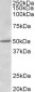 Estrogen receptor beta (aa417-428) Antibody (internal region)