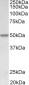 PDCD4 (aa210-221) Antibody (internal region)