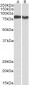 PRKCB Antibody (internal region, near C-Term)