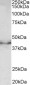 Doublecortin (mouse) Antibody (internal region)