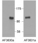 HIC1 (aa396-410) Antibody (internal region)