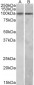HIC1 (aa396-410) Antibody (internal region)